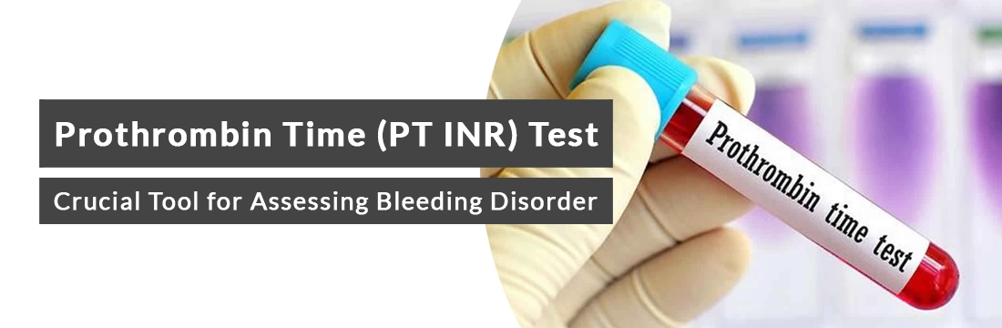 Prothrombin Time (PT INR) Test: Crucial Tool for Assessing Bleeding Disorder